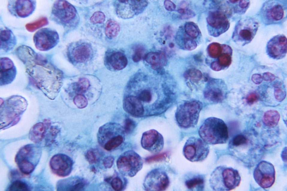 Image, blue stained macrophages under a microscope